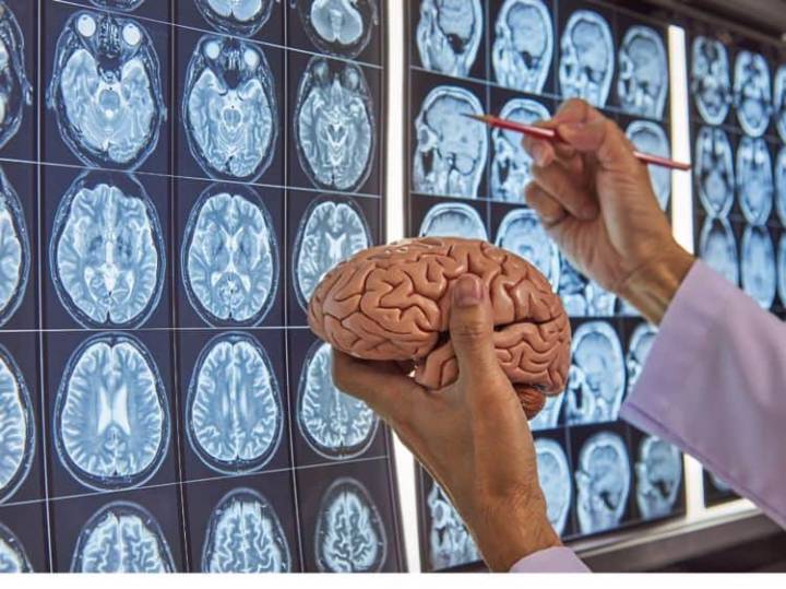 demencia-frontotemporal-una-enfermedad-sin-cura imagen de artículo