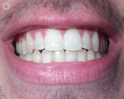 bioestetica-dolor-craneomandibular-cronico