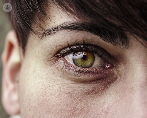 la-blefaroplastia-la-cirugia-para-rejuvenecer-la-mirada imagen de artículo