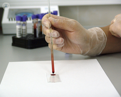 anemia-nutricional