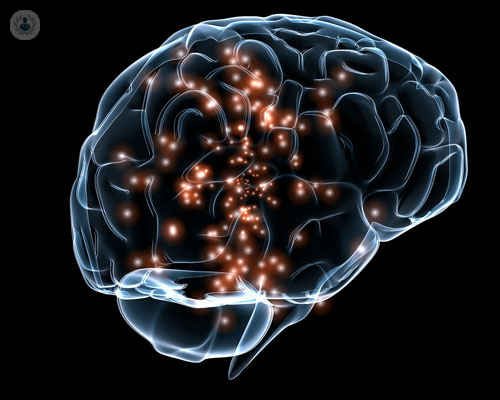 estimulacion-transcraneal