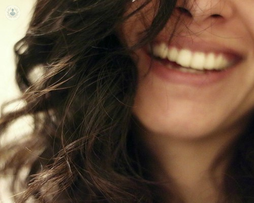 apinamiento-dental-jpg